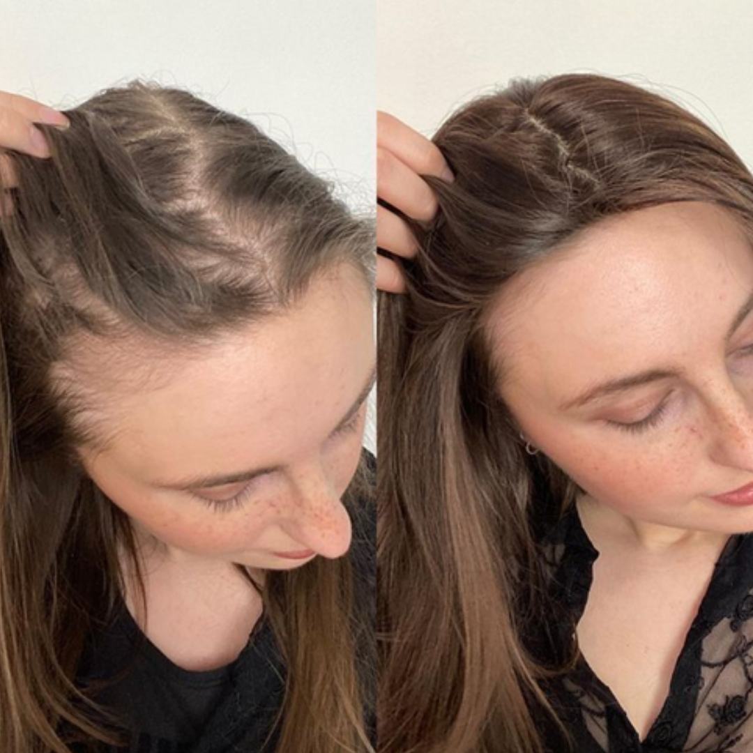 ShougaGROw: το σπρέι για πυκνά μαλλιά